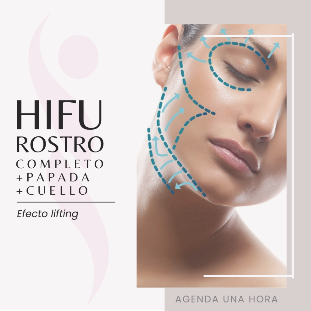 Hifu Rostro Completo Papada Cuello Clínica Estética Concepción